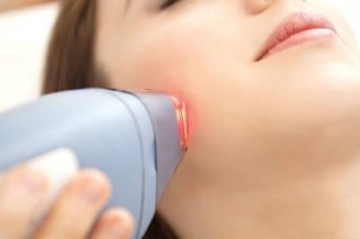 Permalink to Informative Ideas of How Long Does Laser Hair Removal Last